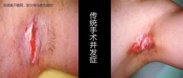 �����ݷ���Ƥ����ҽԺ"