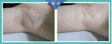 �����ݷ���Ƥ����ҽԺ"