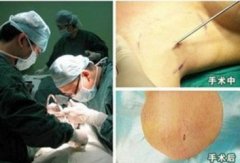 �����ݷ���Ƥ����ҽԺ"