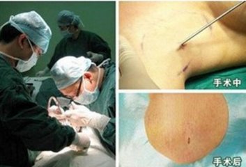 �����ݷ���Ƥ����ҽԺ"