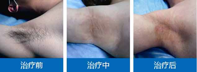 �����ݷ���Ƥ����ҽԺ"