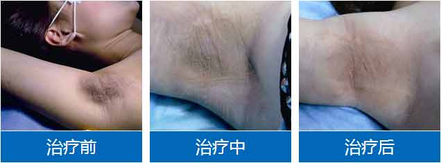 �����ݷ���Ƥ����ҽԺ"