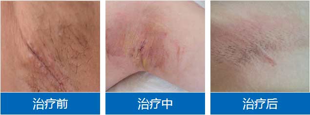 �����ݷ���Ƥ����ҽԺ"