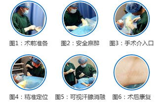 “广州肤康皮肤病医院"