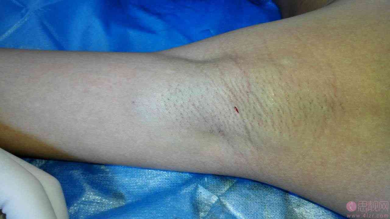 “广州肤康皮肤病医院"